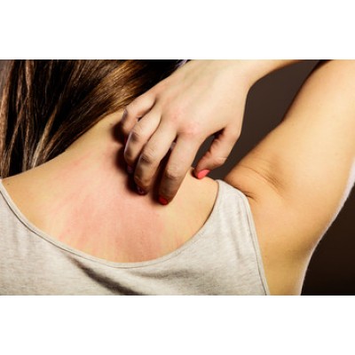 Problemi-della-pelle