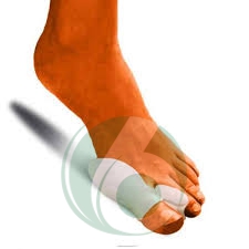 Protezione Alluce Valgo con Separatore Dito Integrato OK PED ORIONE